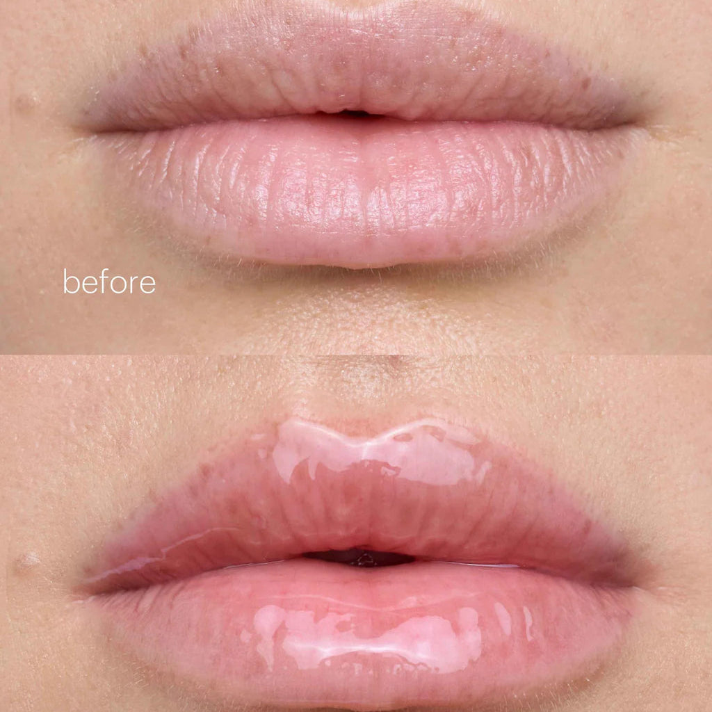 Collagen Lip Gel Masks