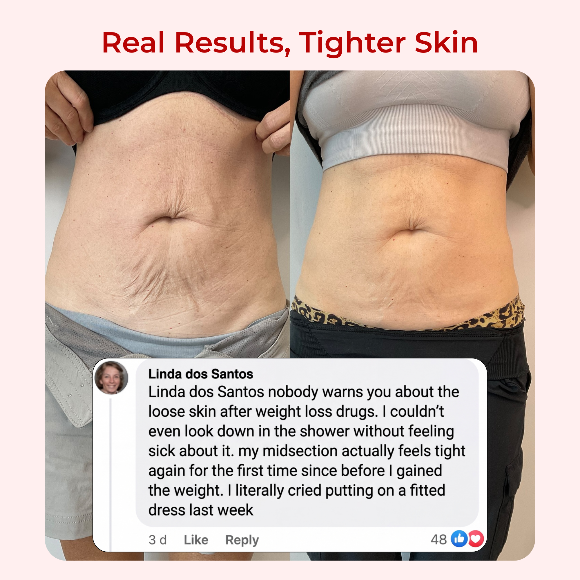 BeamBody™ Red Light Loose Skin Firming Belt
