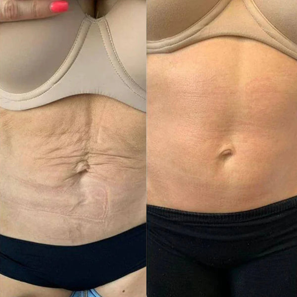 Week 10-12